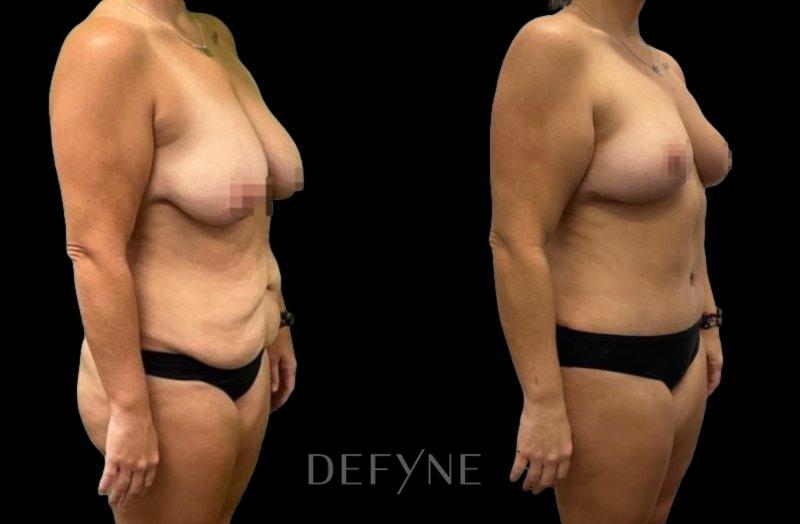 Patient #10988 Combined Image