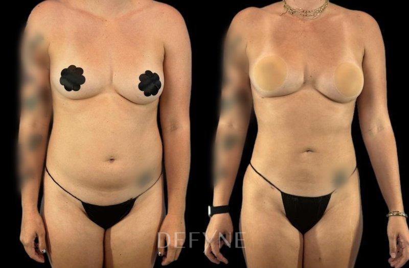 Patient #15197 Combined Image