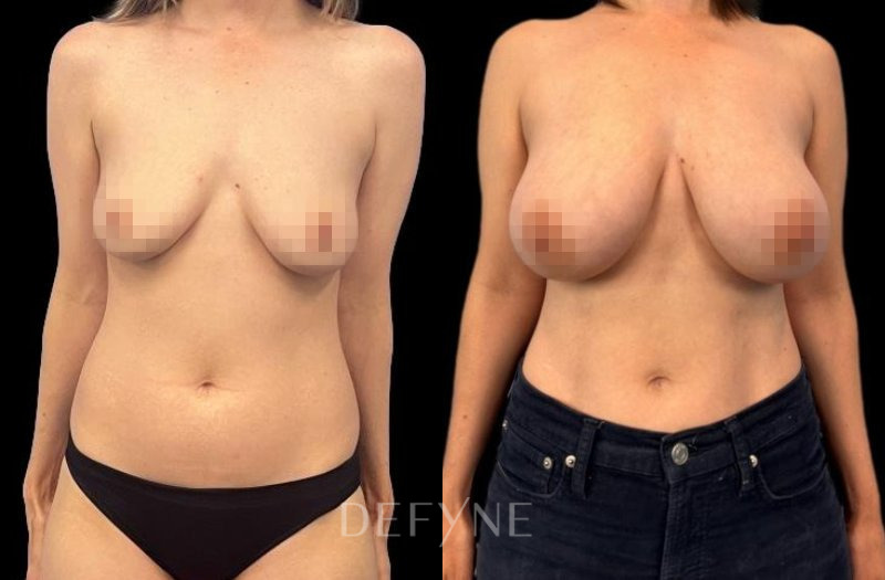 Patient #25049 Combined Image