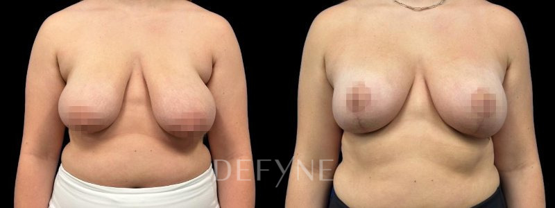 Patient #60576 Combined Image