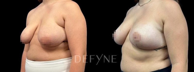 Patient #60576 Combined Image