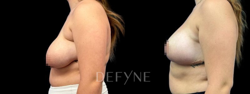 Patient #60576 Combined Image