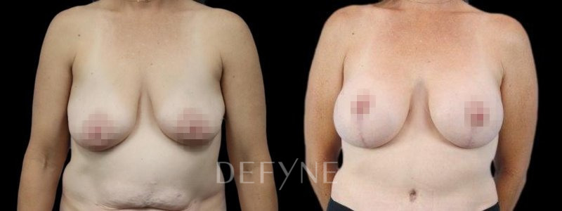 Patient #83796 Combined Image