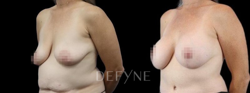 Patient #83796 Combined Image