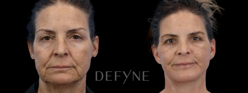 Patient #20066 Combined Image