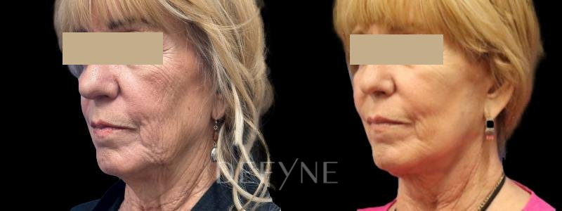 Patient #99649 Combined Image