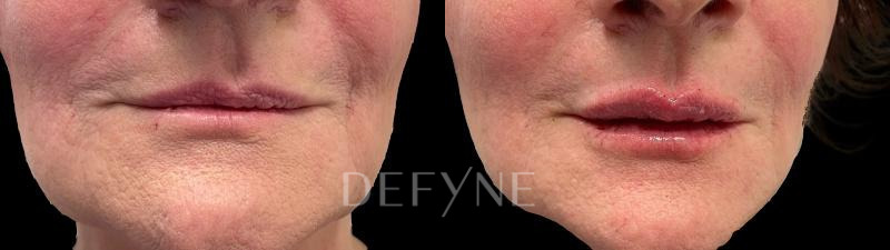 Patient #22841 Combined Image