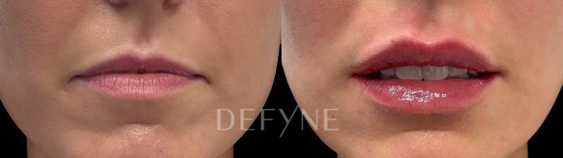 Patient #79571 Combined Image