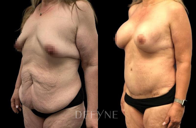 Patient #72589 Combined Image