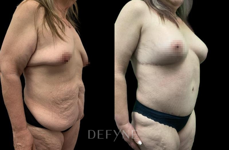 Patient #72589 Combined Image