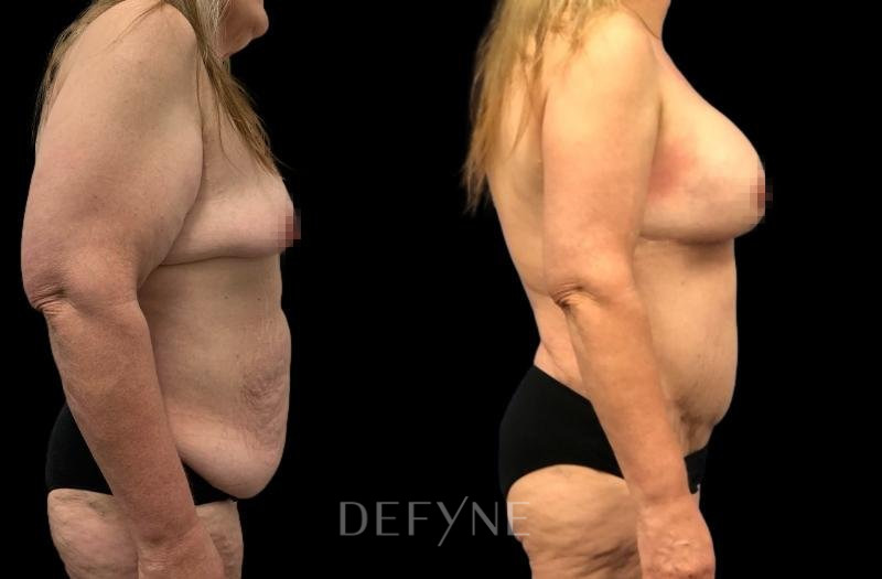 Patient #72589 Combined Image