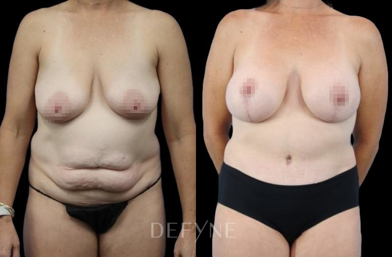 Patient #10139 Combined Image