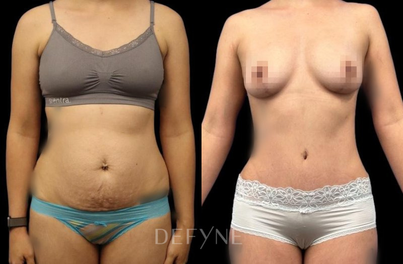 Patient #72280 Combined Image