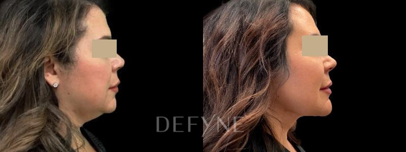 Patient #29874 Combined Image