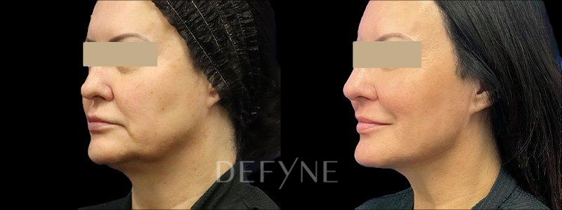 Patient #33472 Combined Image