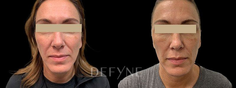 Patient #33473 Combined Image