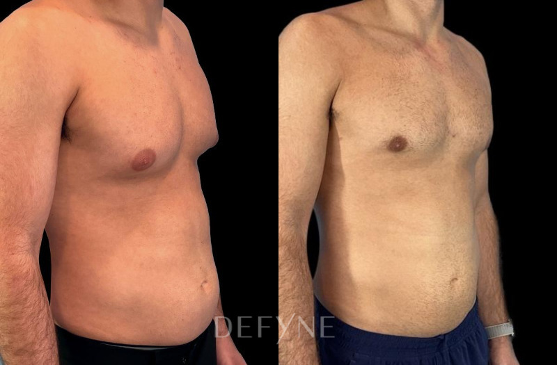 Patient #37185 Combined Image