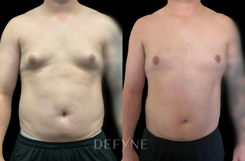 Patient #37184 Combined Image