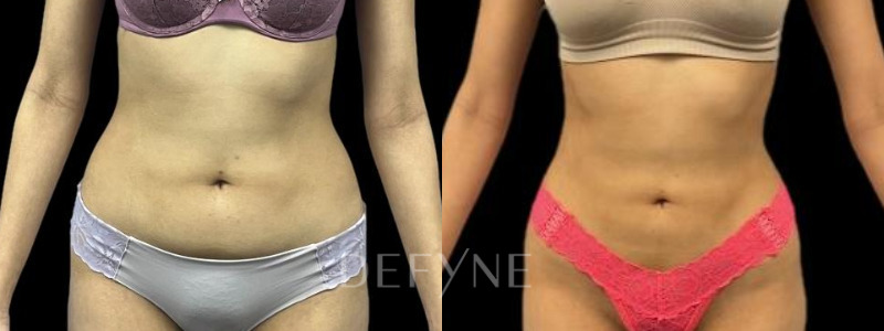 Patient #68062 Combined Image