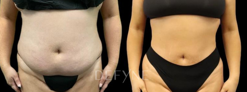 Patient #75695 Combined Image