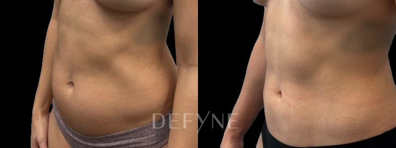 Patient #72807 Combined Image