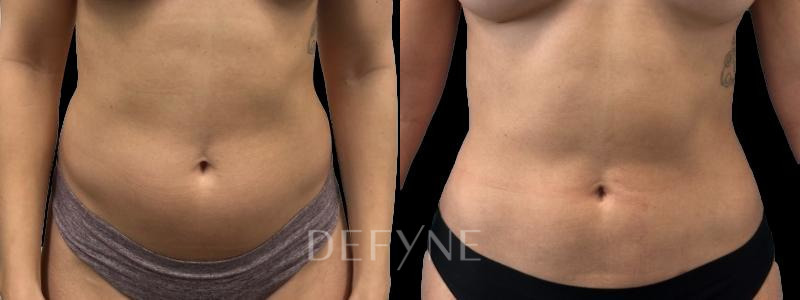 Patient #72807 Combined Image