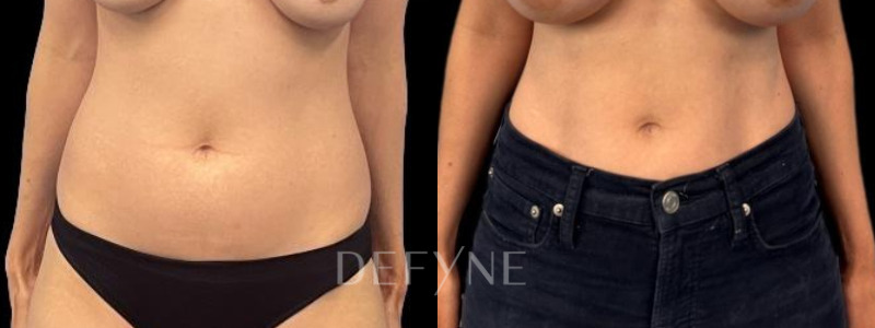 Patient #29416 Combined Image