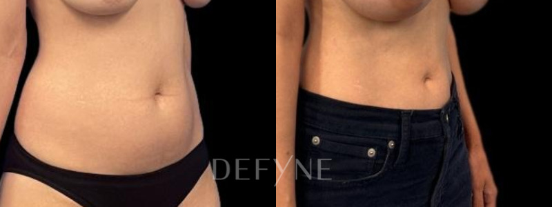 Patient #29416 Combined Image