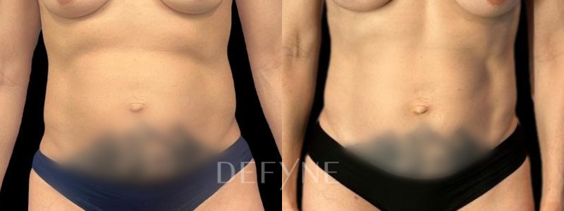 Patient #26904 Combined Image