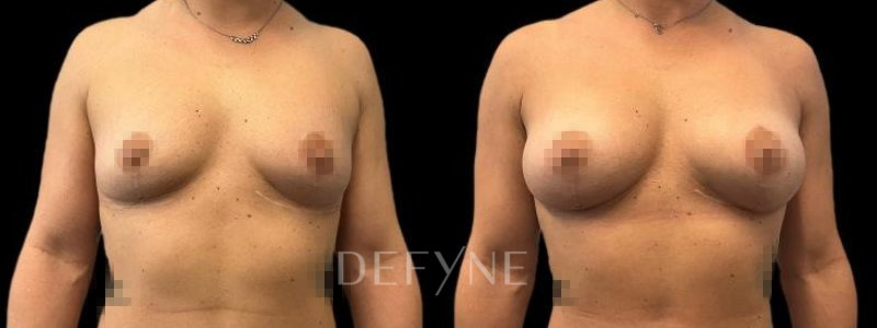 Patient #75828 Combined Image