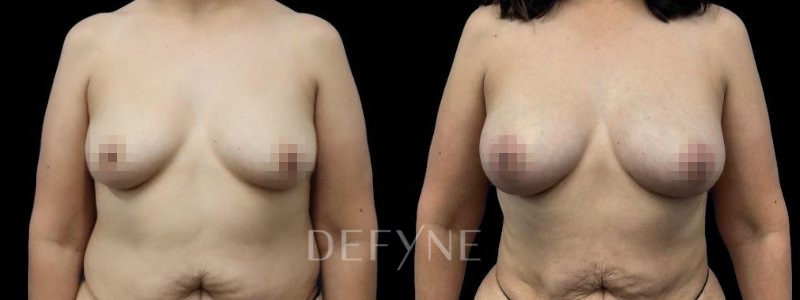 Patient #75827 Combined Image