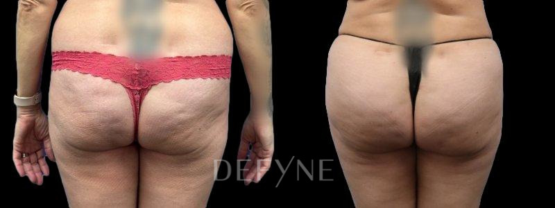 Patient #46502 Combined Image