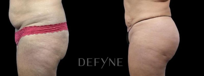 Patient #46502 Combined Image