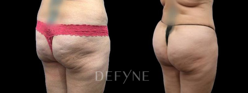 Patient #46502 Combined Image