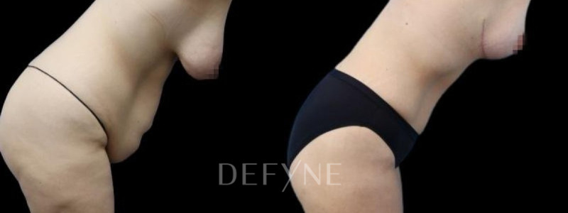 Patient #40714 Combined Image