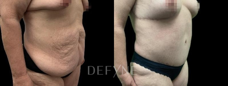 Patient #96569 Combined Image