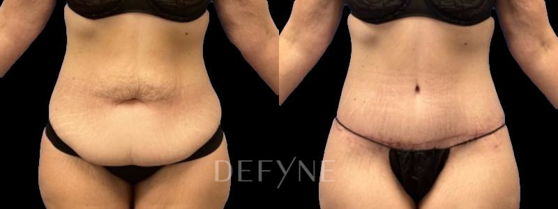 Patient #62125 Combined Image