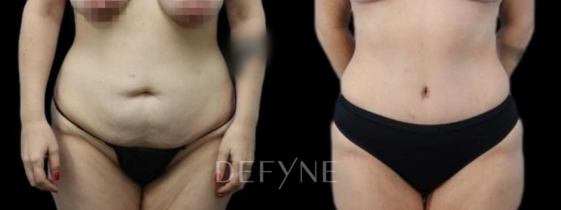 Patient #40714 Combined Image