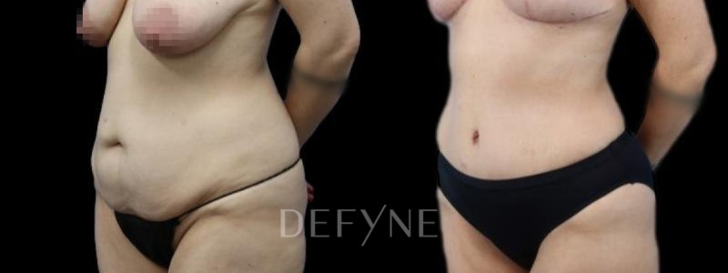 Patient #40714 Combined Image