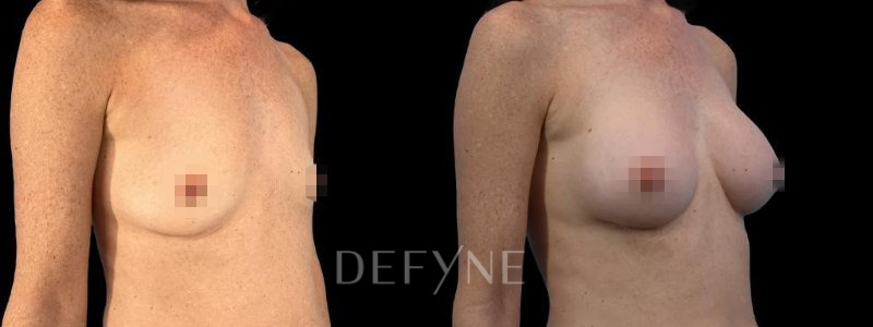 Patient #53462 Combined Image