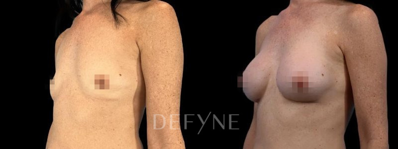 Patient #53462 Combined Image