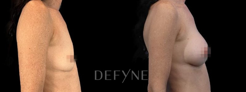 Patient #53462 Combined Image