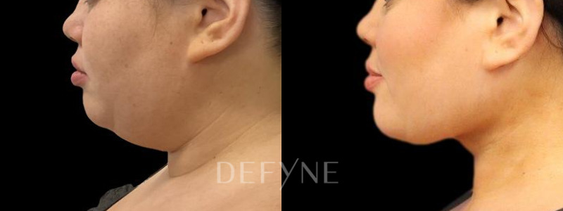 Patient #104895 Combined Image