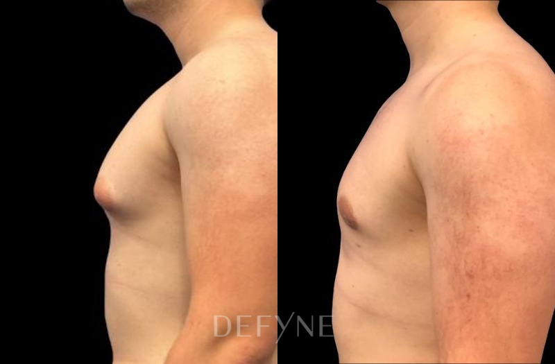 Patient #45563 Combined Image