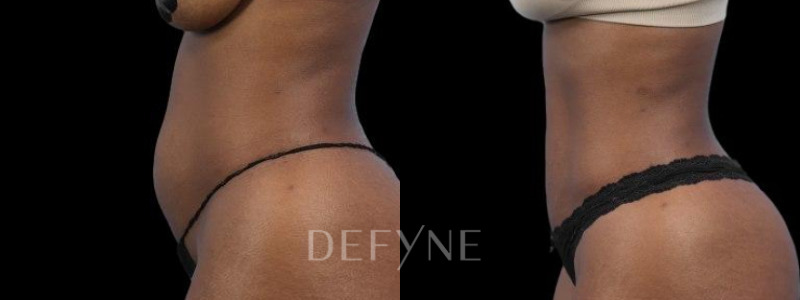 Patient #70298 Combined Image