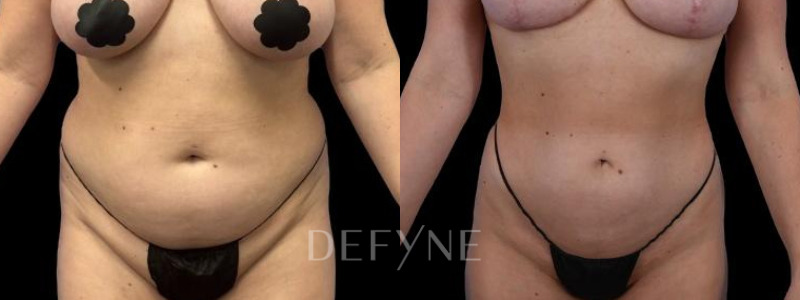 Patient #55814 Combined Image