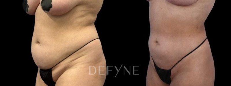 Patient #55814 Combined Image