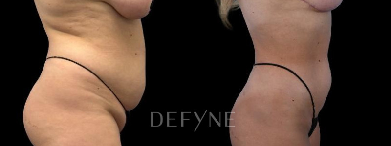 Patient #55814 Combined Image