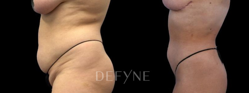 Patient #55814 Combined Image