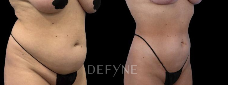 Patient #55814 Combined Image